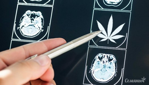 kbd-i-epilepsiya__fZP0UlBEkocAaL6k.jpg kbd-i-epilepsiya__fZP0UlBEkocAaL6k.jpg